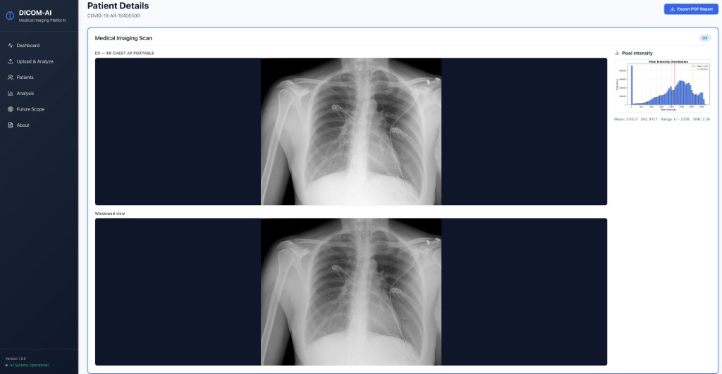 Chest X-ray analysis with pixel intensity distribution and windowed imaging views