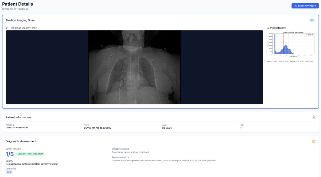 CT chest workflow with diagnostic assessment, recommendations, and PDF report export