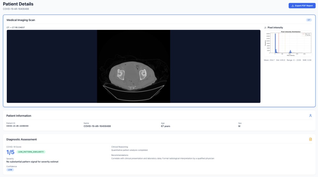 CT scan diagnostic assessment with COVID pattern score, confidence, and clinical reasoning