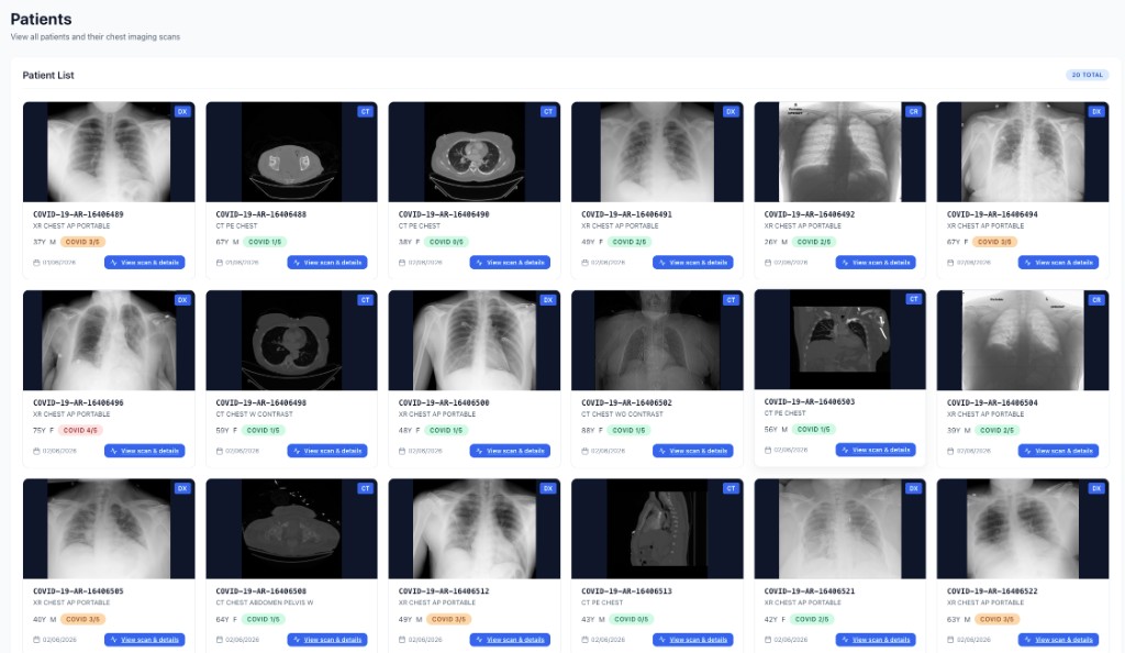 Patient cohort gallery showing chest imaging studies with modality tags and research scores